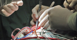 Indian doctors successfully operate on 'miracle baby'